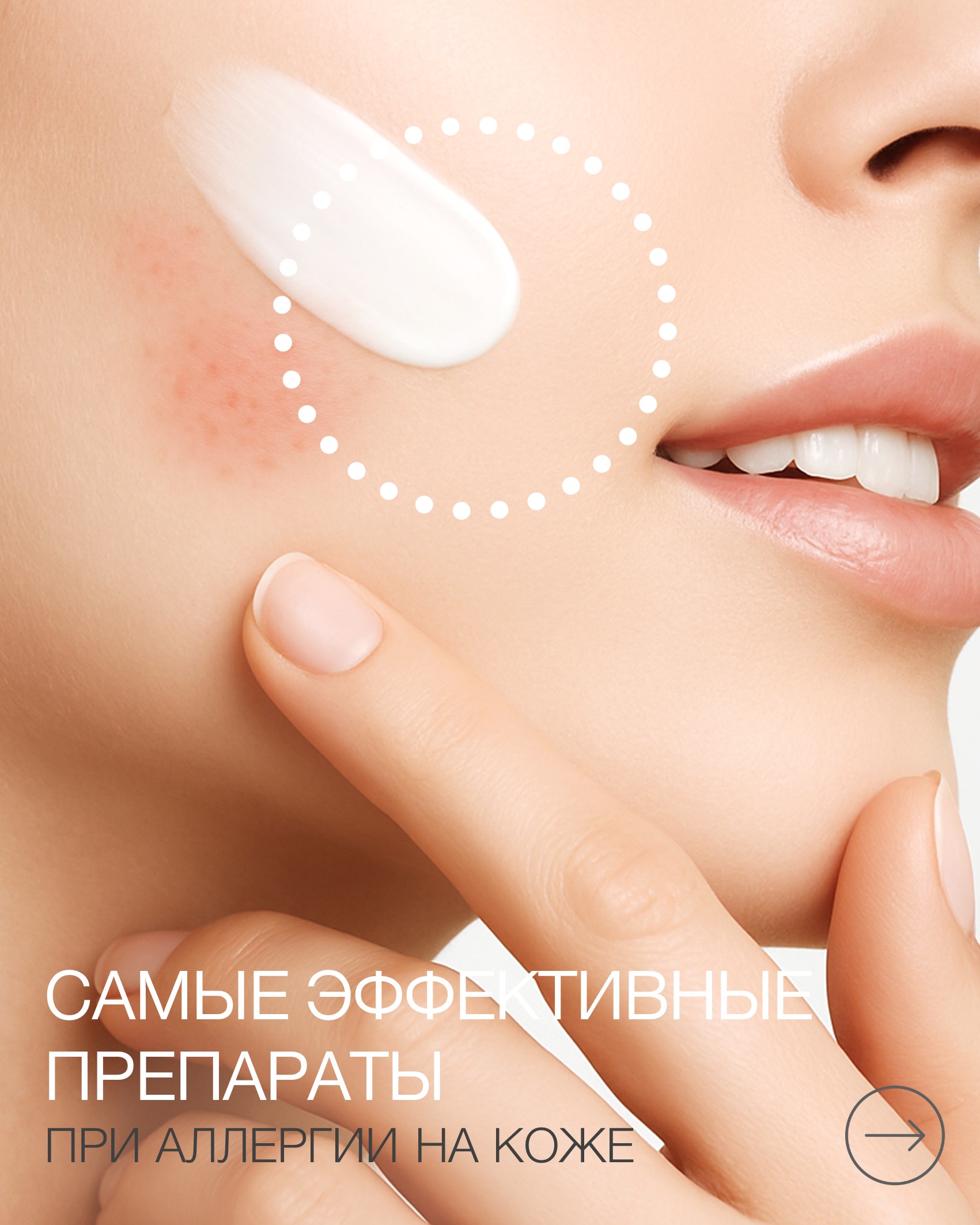 Пост Уход аллергии 3.jpg Пост Уход аллергии 3.jpg